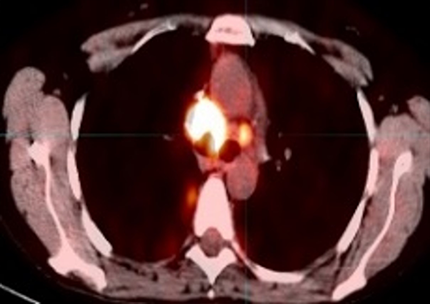 PET/PET CT